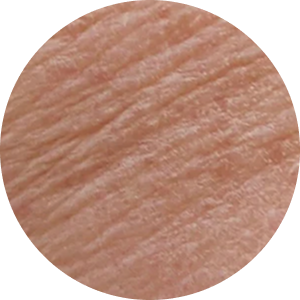 Alternde Haut